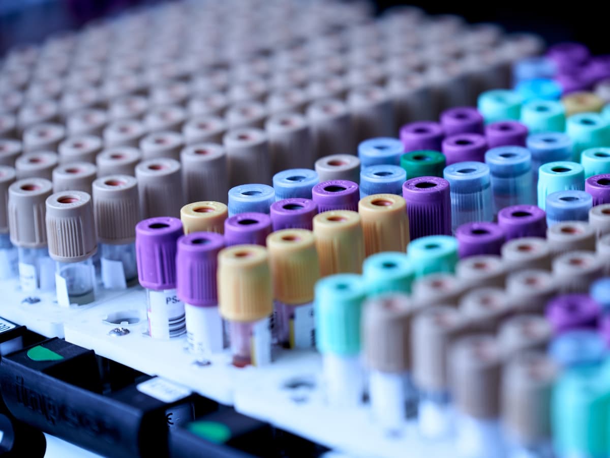 Racks of blood collection tubes with coloured caps in a laboratory